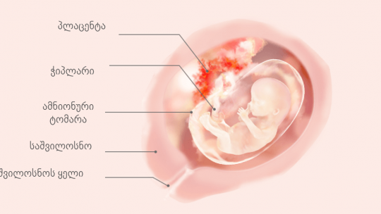 orsulobis 14 kvira